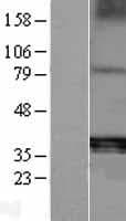 ACP5 / TRAP Protein (Over-Expression Lysate Myc-DDK (Flag))