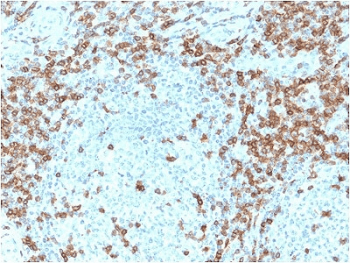 CD5 Antibody (clone CD5/2418)