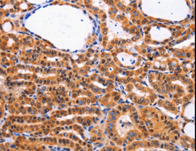 Polyclonal Rabbit anti-Human CDK4 Antibody (IHC, WB)