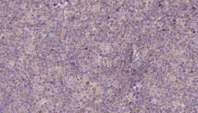 NDUFS7 Antibody