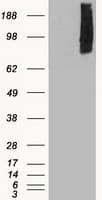 Monoclonal Mouse anti-Human BRAF / B-Raf Antibody (clone OTI4G6, IHC, WB)