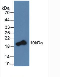 TNFSF11 / RANKL / TRANCE Antibody