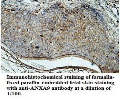 MECP2 Antibody (aa2-211)