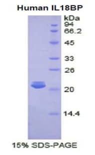 Human IL18BP Protein (Recombinant His)