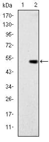 GCK / Glucokinase Antibody (clone 4G6)