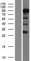 DDX17 Protein (Over-Expression Lysate Myc-DDK (Flag))