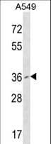 Polyclonal Rabbit anti-Human PCGF2 / MEL-18 Antibody (aa121-150, WB)