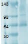 SLC5A5 / NIS Antibody (clone FP5)