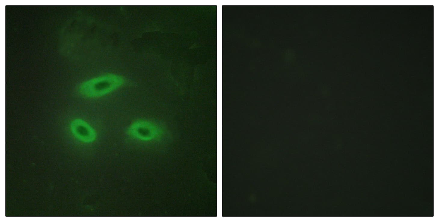 Polyclonal Rabbit anti-Human NKTR Antibody (aa784-833, IHC, IF)