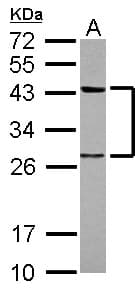 TWF1 / PTK9 Antibody