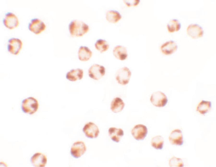 Polyclonal Rabbit anti-Human BCL2L11 / BIM Antibody (IF, WB)