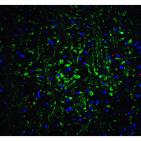 OLIG2 Antibody