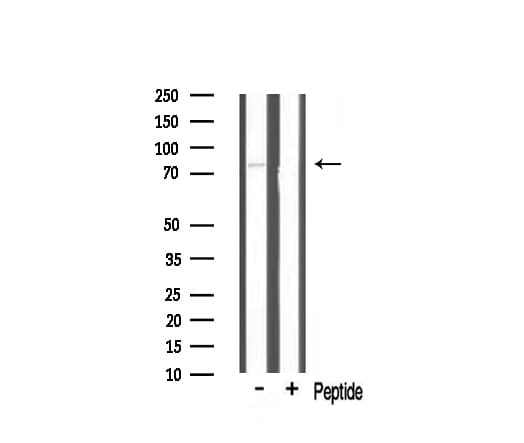 Polyclonal Rabbit anti-Human TBX3 Antibody (IF, WB)