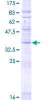 Human CMTM8 Protein (Recombinant GST)