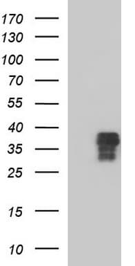 ZFAND3 / TEX27 Antibody (clone OTI1G7)