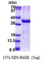 Human ATP1B1 Protein (Recombinant His)