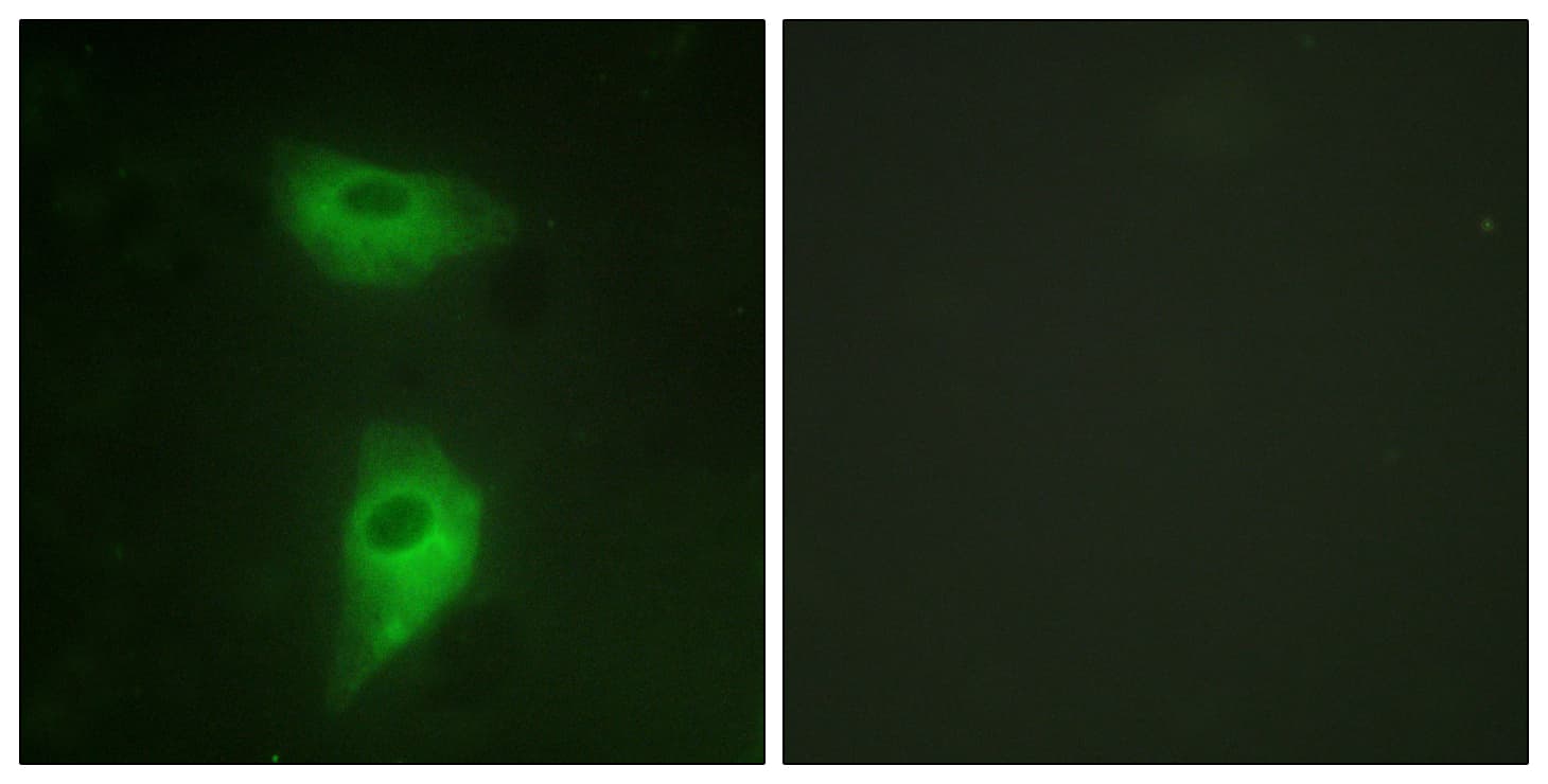 Polyclonal Rabbit anti-Human IGF2R / CD222 Antibody (aa2381-2430, IHC, IF)