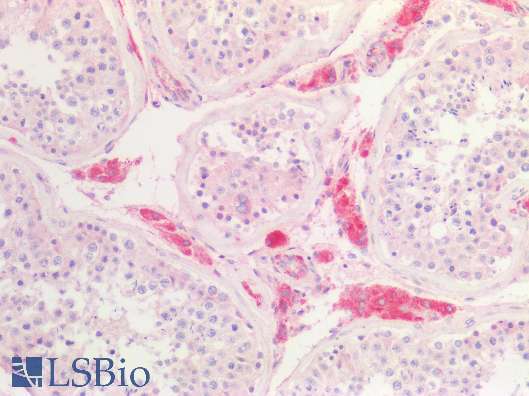 PathPlus™ Polyclonal Rabbit anti-Human APOE / Apolipoprotein E Antibody (IHC, IF)