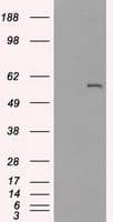 CYP2E1 Antibody (clone OTI5B9)