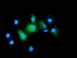BIRC5 / Survivin Antibody (clone OTI6H5)