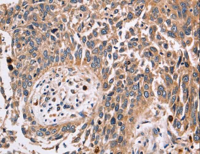 Polyclonal Rabbit anti-Human Alpha Fucosidase / FUCA1 Antibody (IHC, WB)