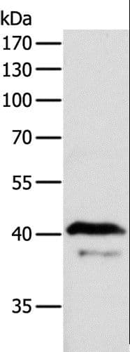 Polyclonal Rabbit anti-Human ADAP1 / CENTA1 Antibody (IHC, WB)