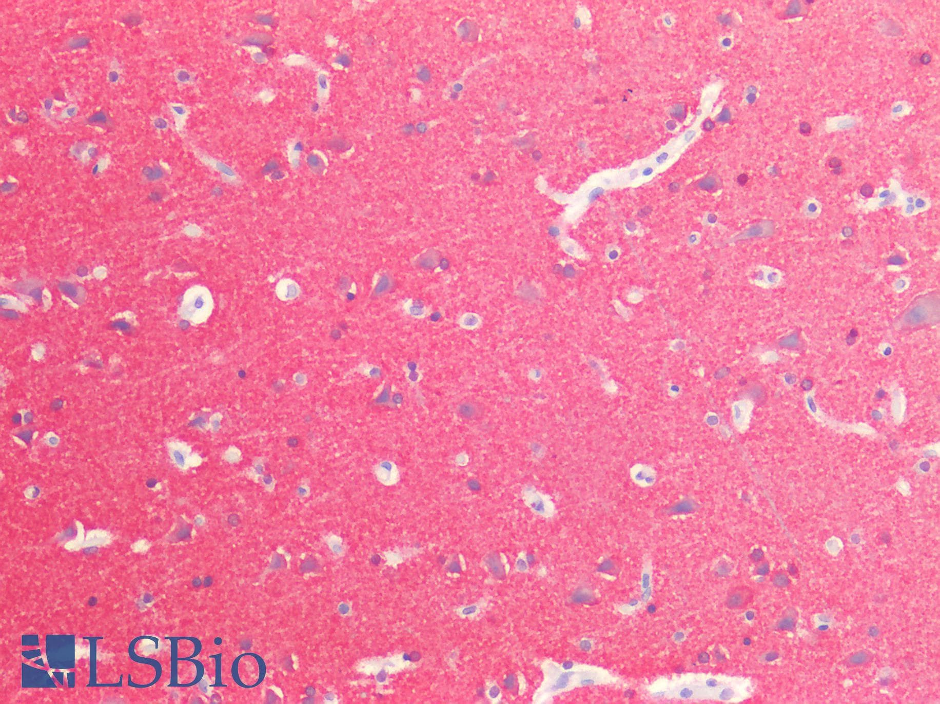 PathPlus™ Polyclonal Rabbit anti-Human MAPT / Tau Antibody (IHC)