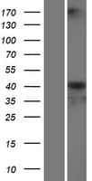 SERPINA6 / CBG Protein (Over-Expression Lysate Myc-DDK (Flag))