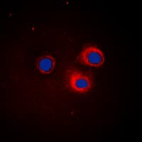 IHC-plus™ Polyclonal Rabbit anti-Human NFKBIE / IKB Epsilon Antibody (Internal, IHC, IF, WB)