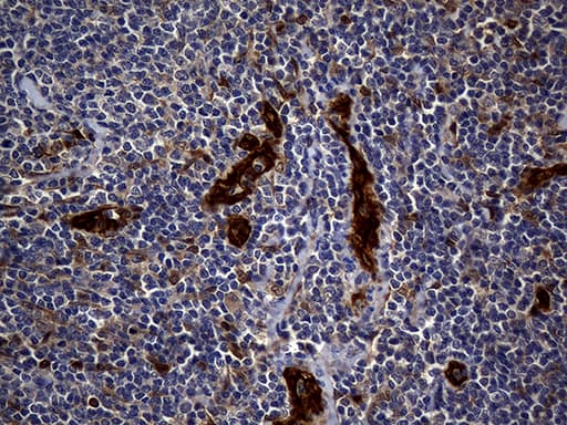 Monoclonal Mouse anti-Human M-PST / STM Antibody (clone OTI3G5, Carrier-free, IHC, WB)