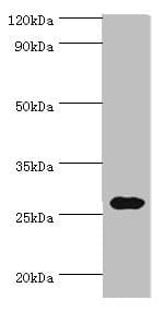 CRISP2 / TSP1 Antibody (aa22-243)