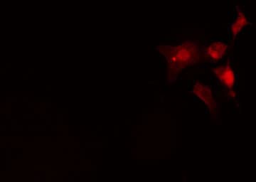 INA / Alpha Internexin Antibody