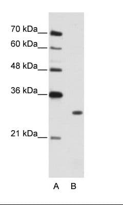 MBNL1 / MBNL Antibody (C-Terminus)
