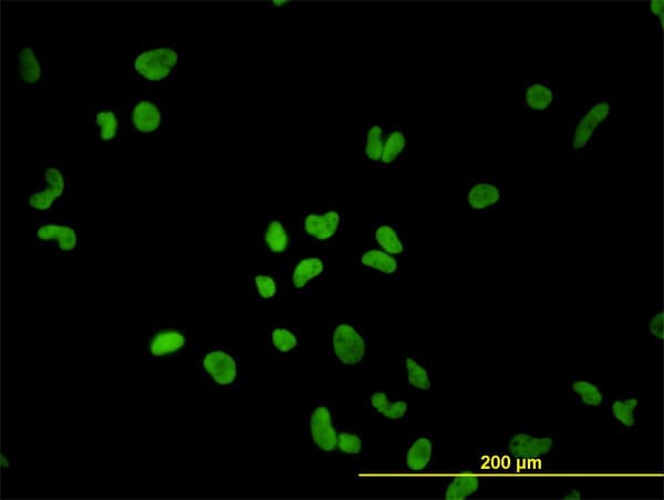 IHC-plus™ PTBP1 Antibody (clone 3H8)