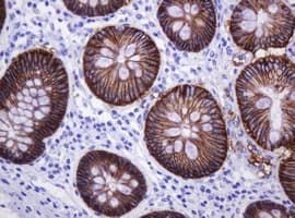 Monoclonal Mouse anti-Human CA12 / Carbonic Anhydrase XII Antibody (clone OTI2C6, IHC, WB)