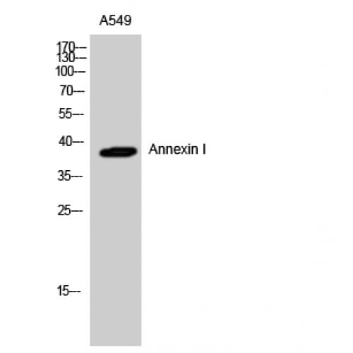 Polyclonal Rabbit anti-Human ANXA1 / Annexin A1 Antibody (10-90 aa, WB)