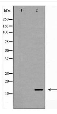 p14ARF / CDKN2A Antibody
