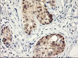 LPL / Lipoprotein Lipase Antibody (clone OTI3A10)