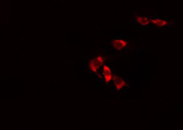 ALDH3B1 Antibody