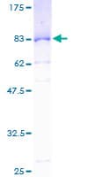 Human PAI-RBP1 / SERBP1 Protein (Recombinant GST)