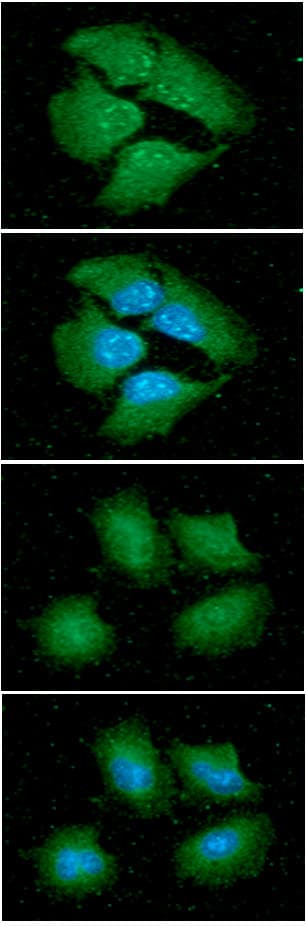 YWHAE / 14-3-3 Epsilon Antibody (clone AT4F8)