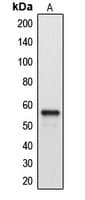 Polyclonal Rabbit anti-Human CYP2A7 Antibody (C-Terminus, IHC, WB)