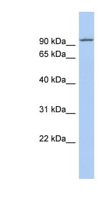 KIF9 Antibody (N-Terminus)