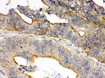 OSM / Oncostatin M Antibody