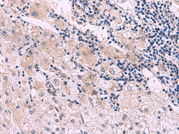 MIBP / ITGB1BP3 Antibody
