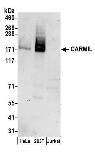 LRRC16 / CARMIL Antibody (aa1321-1371)