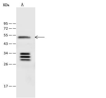 Polyclonal Rabbit anti-Mouse KRT17 / CK17 / Cytokeratin 17 Antibody (Preservative Free, WB)