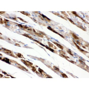 Polyclonal Rabbit anti-Human MAOA / Monoamine Oxidase Antibody (aa457-493, IHC, WB)