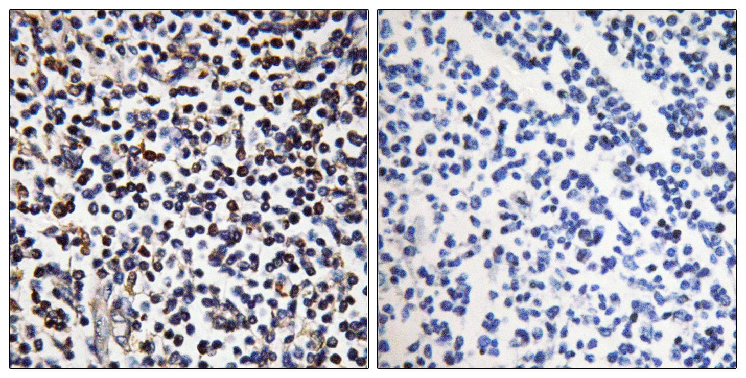 STK17B / DRAK2 Antibody
