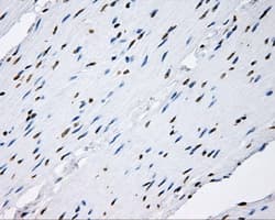 p66 / SHC Antibody (clone OTI1H8)